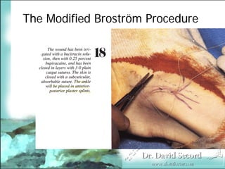 BroströM Procedure Presentation