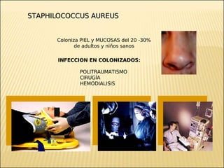 Brote Hospitalario de Infecciones Multirresistentes