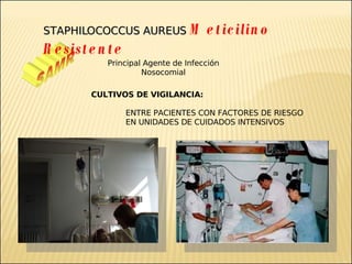 Brote Hospitalario de Infecciones Multirresistentes