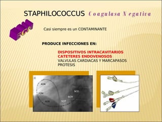 Brote Hospitalario de Infecciones Multirresistentes