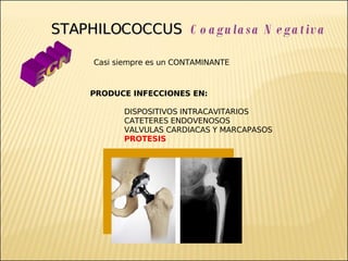 Brote Hospitalario de Infecciones Multirresistentes