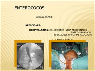 Brote Hospitalario de Infecciones Multirresistentes