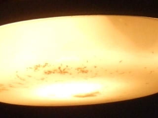 Brote Hospitalario de Infecciones Multirresistentes