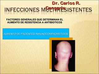 Brote Hospitalario de Infecciones Multirresistentes