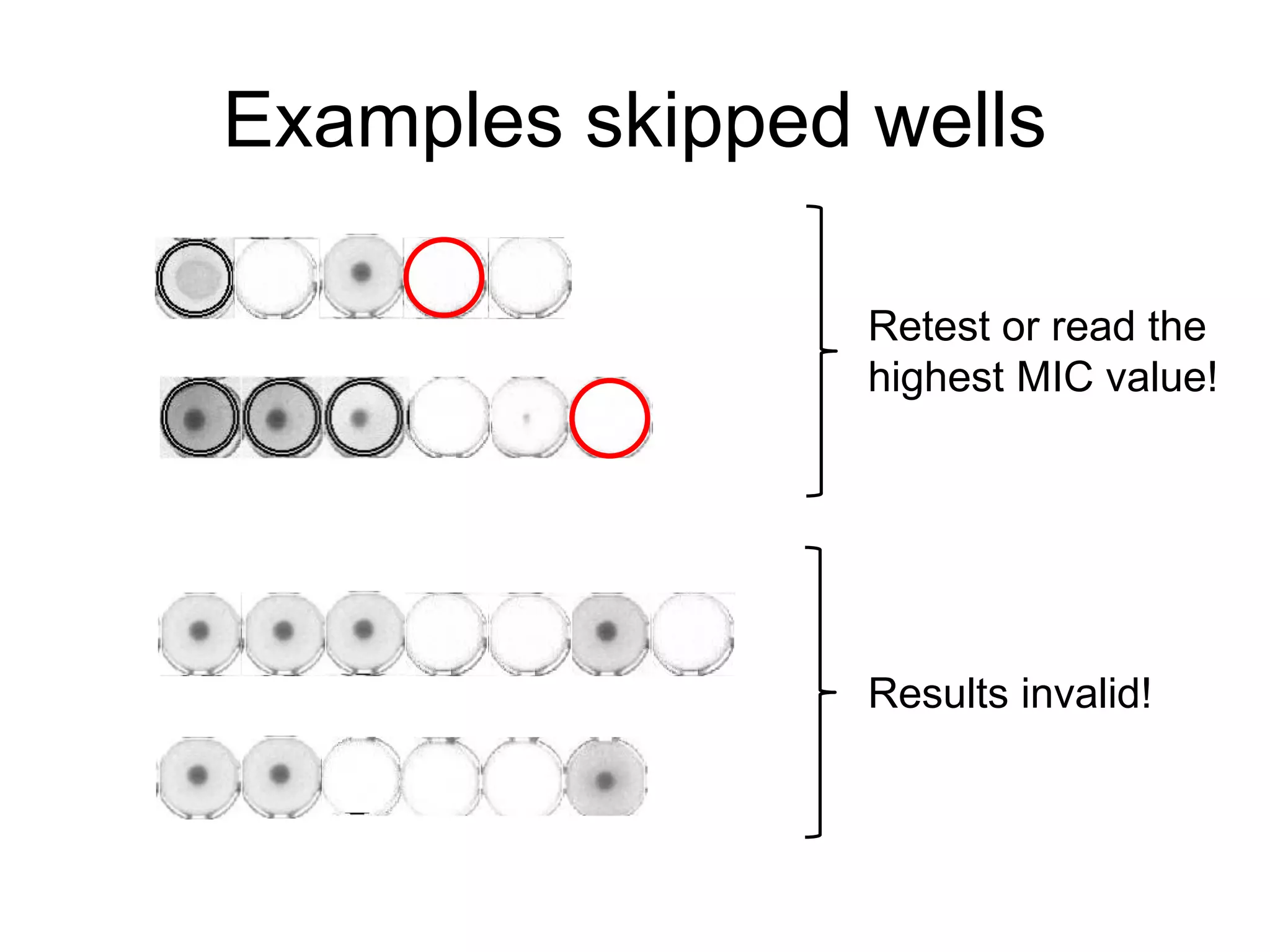 Examples skipped wells
Retest or read the
highest MIC value!
Results invalid!
 