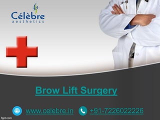 Brow Lift Surgery
www.celebre.in +91-7226022226
 
