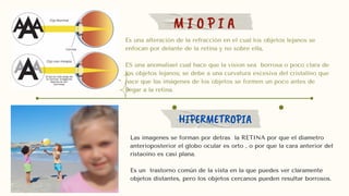 M I O P I A
HIPERMETROPIA
Es una alteración de la refracción en el cual los objetos lejanos se
enfocan por delante de la retina y no sobre ella,
ES una anomaliael cual hace que la vision sea borrosa o poco clara de
los objetos lejanos; se debe a una curvatura excesiva del cristalino que
hace que las imágenes de los objetos se formen un poco antes de
llegar a la retina.
Las imagenes se forman por detras la RETINA por que el diametro
anterioposterior el globo ocular es orto , o por que la cara anterior del
ristaoino es casi plana.
Es un trastorno común de la vista en la que puedes ver claramente
objetos distantes, pero los objetos cercanos pueden resultar borrosos.
 