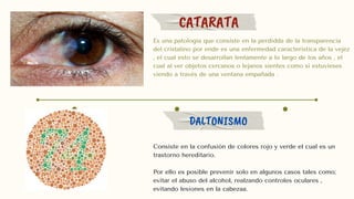 CATARATA
DALTONISMO
Es una patologia que consiste en la perdidda de la transparencia
del cristalino por ende es una enfermedad característica de la vejez
, el cual esto se desarrollan lentamente a lo largo de los años , el
cual al ver objetos cercanos o lejanos sientes como si estuvieses
viendo a través de una ventana empañada .
Consiste en la confusión de colores rojo y verde el cual es un
trastorno hereditario.
Por ello es posible prevenir solo en algunos casos tales como;
evitar el abuso del alcohol, realzando controles oculares ,
evitando lesiones en la cabezaa.
 