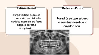 Tabique Nasal Paladar Duro
Pared vertical de hueso
o partición que divide la
cavidad nasal en las fosas
nasales derecha
e izquierda .
Pared ósea que separa
la cavidad nasal de la
cavidad oral.
 