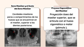 Seno Maxilar y el Suelo
del Seno Maxilar Proceso Cigomático
del Maxilar
Cavidades maxilares
pares o compartimentos de los
huesos que se encuentran en
el maxilar, superior a los
dientes posteriores.
Proyección ósea del
maxilar superior, que se
articula con el hueso
cigomático o malar
(pómulo ).
 