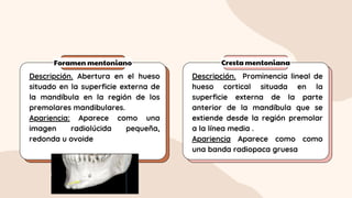 Foramen mentoniano Cresta mentoniana
Descripción. Abertura en el hueso
situado en la superficie externa de
la mandíbula en la región de los
premolares mandibulares.
Apariencia: Aparece como una
imagen radiolúcida pequeña,
redonda u ovoide
Descripción. Prominencia lineal de
hueso cortical situada en la
superficie externa de la parte
anterior de la mandíbula que se
extiende desde la región premolar
a la línea media .
Apariencia Aparece como como
una banda radiopaca gruesa
 