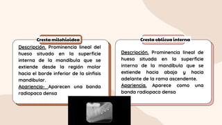 Cresta milohioidea Cresta oblicua interna
Descripción. Prominencia lineal del
hueso situado en la superficie
interna de la mandíbula que se
extiende desde la región molar
hacia el borde inferior de la sínfisis
mandibular.
Apariencia- Aparecen una banda
radiopaca densa
Descripción. Prominencia lineal de
hueso situada en la superficie
interna de la mandíbula que se
extiende hacia abajo y hacia
adelante de la rama ascendente.
Apariencia. Aparece como una
banda radiopaca densa
 