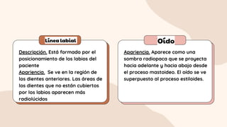 Línea labial Oído
Descripción. Está formado por el
posicionamiento de los labios del
paciente
Apariencia. Se ve en la región de
los dientes anteriores. Las áreas de
los dientes que no están cubiertos
por los labios aparecen más
radiolúcidos
Apariencia. Aparece como una
sombra radiopaca que se proyecta
hacia adelante y hacia abajo desde
el proceso mastoideo. El oído se ve
superpuesto al proceso estiloides.
 