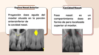 Espina Nasal Anterior Cavidad Nasal
Proyección ósea aguda del
maxilar situada en la porción
anteroinferior de
la cavidad nasal.
Fosa nasal: es un
compartimiento óseo en
forma de pera localizada
superior al maxilar.
 