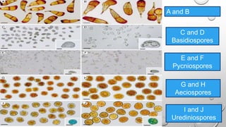 A and B
Teliospores
C and D
Basidiospores
E and F
Pycniospores
G and H
Aeciospores
E and F
Pycniospores
I and J
Urediniospores
 