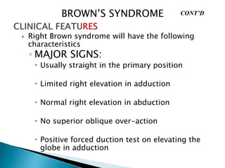 brown-s-syndrome-pptx