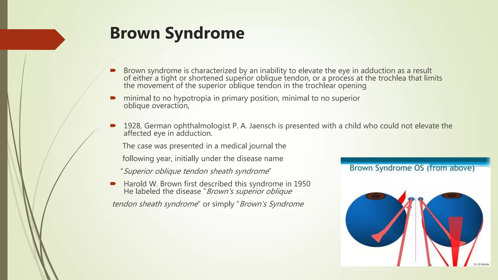 brown-syndrome-pptx