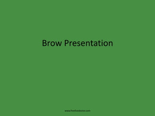 Brow Presentation www.freelivedoctor.com 
