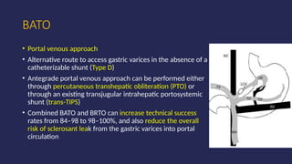 BRTO MODIFICATIONS- iNTERVENTIONAL RADIOLOGIST PERSPECTIVE | PPTX