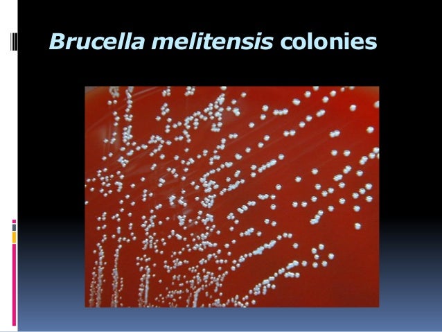 Brucella mahadi ppt