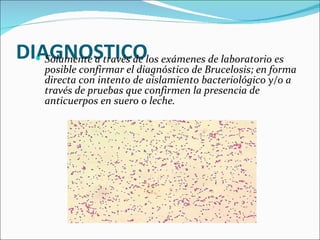 DIAGNOSTICO Solamente a través de los exámenes de laboratorio es posible confirmar el diagnóstico de Brucelosis; en forma directa con intento de aislamiento bacteriológico y/o a través de pruebas que confirmen la presencia de anticuerpos en suero o leche. 