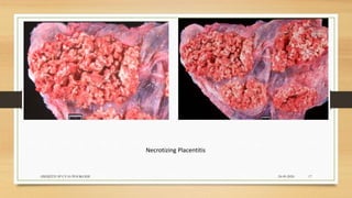 Necrotizing Placentitis
24-09-2020ABHIJITH SP CVAS POOKODE 17
 