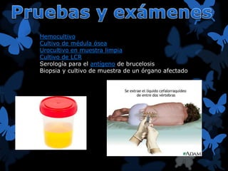 Hemocultivo 
Cultivo de médula ósea 
Urocultivo en muestra limpia 
Cultivo de LCR 
Serología para el antígeno de brucelosis 
Biopsia y cultivo de muestra de un órgano afectado 
