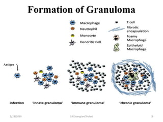 Formation of Granuloma
1/28/2019 G.R Syangtan(Shulav) 19
Antigen
 