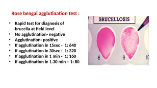 Rose bengal agglutination test :
• Rapid test for diagnosis of
brucella at field level
• No agglutination- negative
• Agglutination- positive
• If agglutination in 15sec - 1: 640
• If agglutination in 30sec - 1: 320
• If agglutination in 1 min - 1: 160
• If agglutination in 1.30 min – 1: 80
 