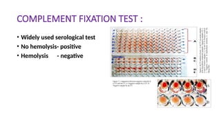 COMPLEMENT FIXATION TEST :
• Widely used serological test
• No hemolysis- positive
• Hemolysis - negative
 