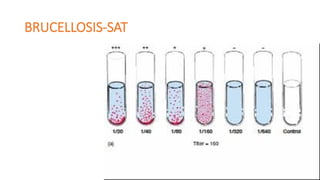 BRUCELLOSIS-SAT
 