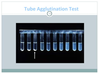 13
Tube Agglutination Test
 