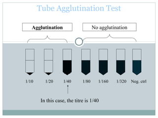 No agglutinationAgglutination
1/10 1/20 1/40 1/80 1/160 1/320 Neg. ctrl
In this case, the titre is 1/40
Tube Agglutination Test
 