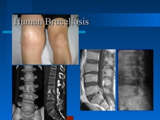 Beneficial approaches for controlling brucellosis