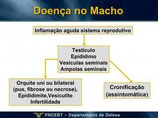 PNCEBT - Departamento de Defesa
Inflamação aguda sistema reprodutivo
Orquite uni ou bilateral
(pus, fibrose ou necrose),
Epididimite,Vesiculite
Infertilidade
Testículo
Epidídimo
Vesículas seminais
Ampolas seminais
Cronificação
(assintomática)
Doença no MachoDoença no Macho
 