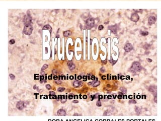 Epidemiología, clínica,

Tratamiento y prevención
 