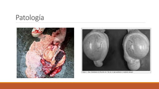 Patología
 