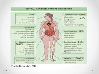 2-5%




                               1-2%



                              2-5%
    20-40%




                             20-60%


Fuente: Papas; et al, 2010
 