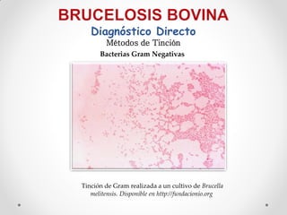 Diagnóstico Directo
        Métodos de Tinción
      Bacterias Gram Negativas




Tinción de Gram realizada a un cultivo de Brucella
   melitensis. Disponible en http://fundacionio.org
 