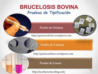 Pruebas de Tipificación


         Prueba de Oxidasa

  http://quimicoclinico.wordpress.com


          Prueba de Catalasa


   http://quimicoclinico.wordpress.com


         Prueba de Ureasa


  http://faculty.lacitycollege.edu
 