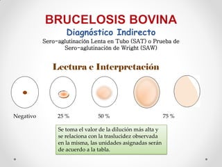 Diagnóstico Indirecto
           Sero-aglutinación Lenta en Tubo (SAT) o Prueba de
                  Sero-aglutinación de Wright (SAW)


              Lectura e Interpretación




Negativo        25 %            50 %                         75 %

                Se toma el valor de la dilución más alta y
                se relaciona con la traslucidez observada
                en la misma, las unidades asignadas serán
                de acuerdo a la tabla.
 