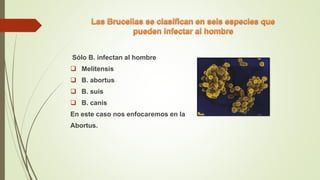 Sólo B. infectan al hombre
 Melitensis
 B. abortus
 B. suis
 B. canis
En este caso nos enfocaremos en la
Abortus.
 