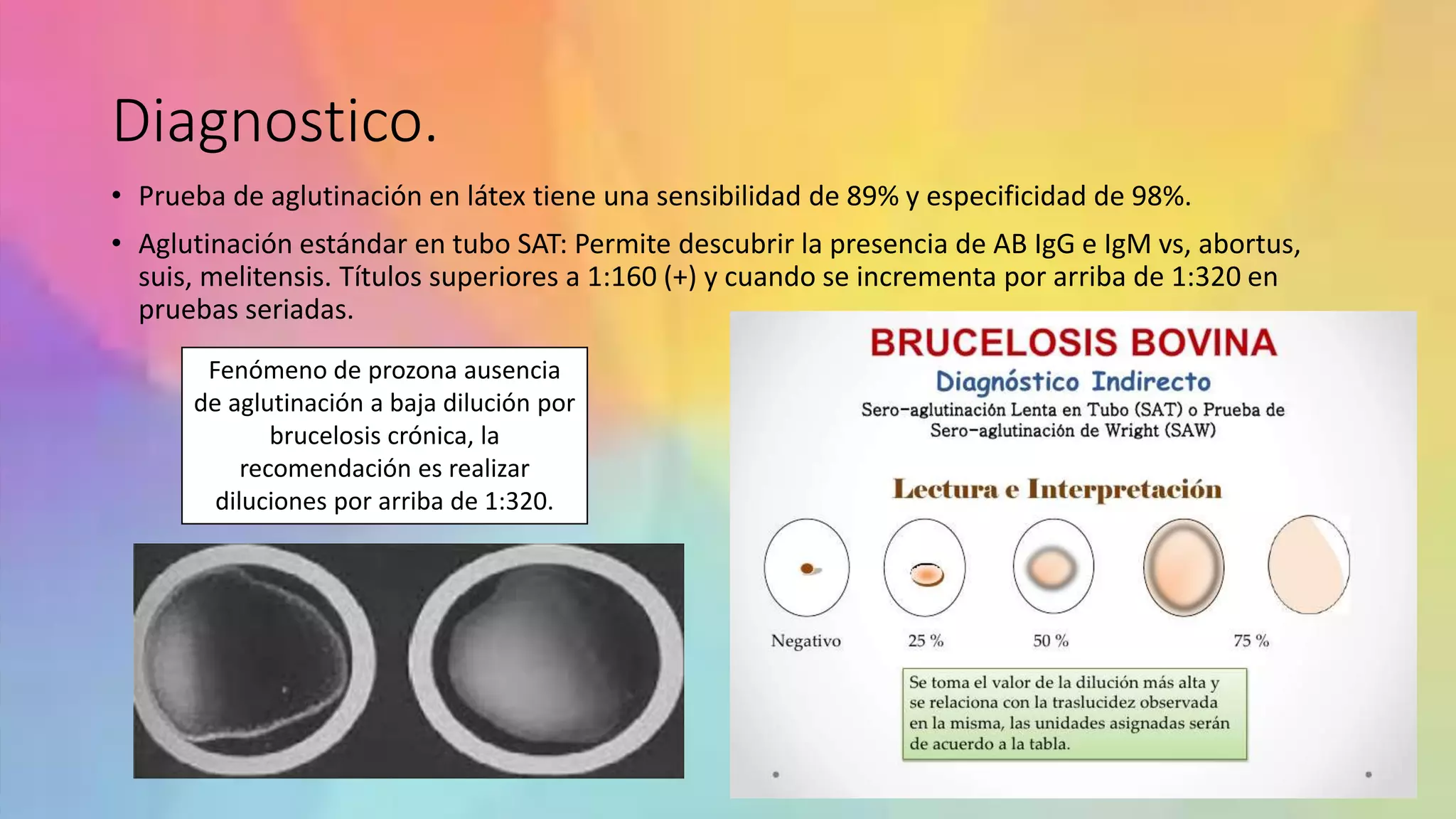 Brucelosis o fiebre ondulante. | PPTX