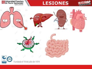 LESIONES
 