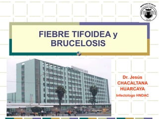 FIEBRE TIFOIDEA y
BRUCELOSIS
2001- 2002
Dr. Jesús
CHACALTANA
HUARCAYA
Infectologo HNDAC
 