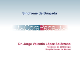 Síndrome de Brugada Dr. Jorge Valentín López Solórzano Residente de cardiología Hospital Juárez de México 