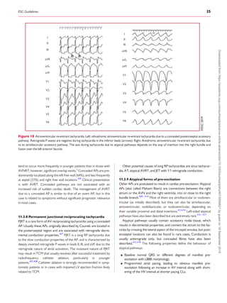 Brugada 2020--esc-guidelines-for-the-management-supraventricular ...