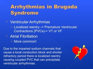  Ventricular Arrhythmias
› Localized reentry -> Premature Ventricular
Contractions (PVCs)-> VT or VF
 Atrial Fibrillation
› More common!
Due to the impaired sodium channels that
cause a local conduction block and shorter
refractory period there is localized reentry
causing coupled PVC that can precipitate
ventricular arrhythmias.
 