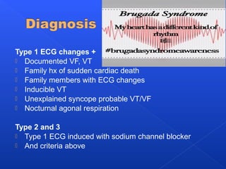 Type 1 ECG changes +
 Documented VF, VT
 Family hx of sudden cardiac death
 Family members with ECG changes
 Inducible VT
 Unexplained syncope probable VT/VF
 Nocturnal agonal respiration
Type 2 and 3
 Type 1 ECG induced with sodium channel blocker
 And criteria above
 
