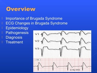  Importance of Brugada Syndrome
 ECG Changes in Brugada Syndrome
 Epidemiology
 Pathogenesis
 Diagnosis
 Treatment
 